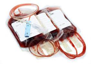 ه دلیل شیوع بیماري کرونا اهداي خون در استان يزد تا ۵۰ درصد کاهش داشته است.