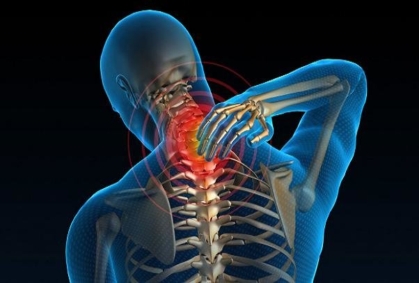 گردن درد عامل بروز سردردهای شایع