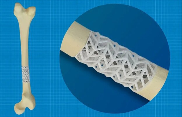 توسعه داربست زیستی برای ترمیم استخوان‌های شکسته