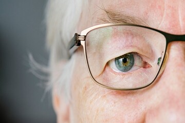 پیرچشمی چیست و چه زمانی بروز می‌کند؟