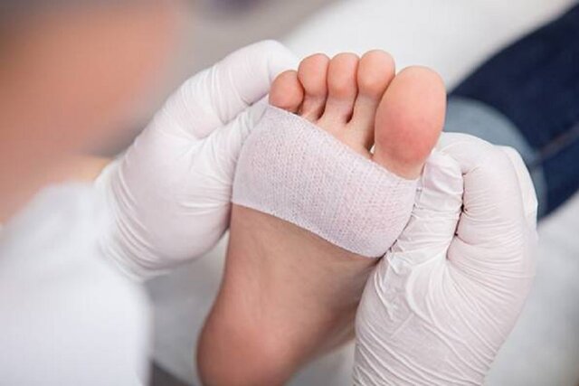 مراقبت از زخم پای دیابتی در شرایط جنگ و بحران