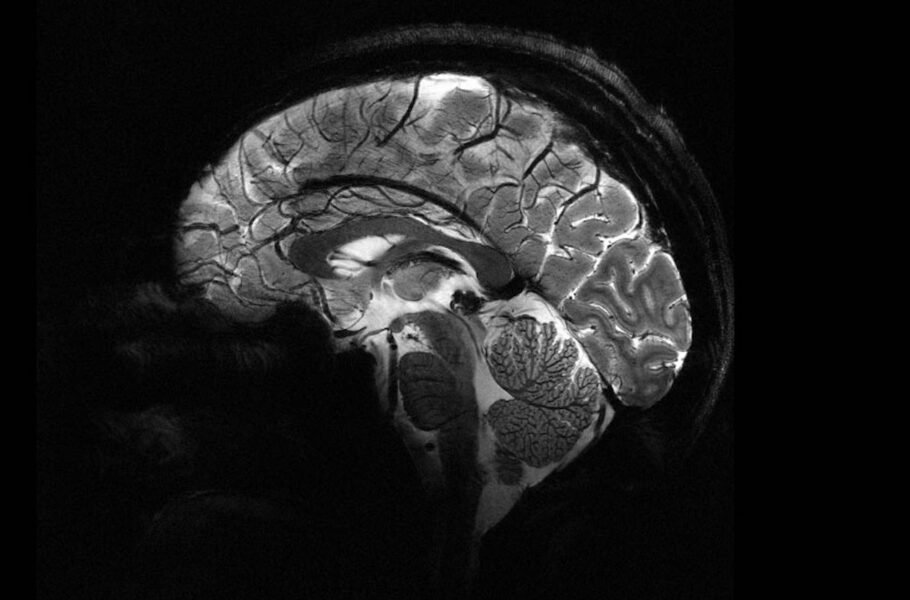 قدرتمندترین دستگاه MRI جهان، اولین تصاویر مغزی خود را با جزئیات بالا ثبت کرد