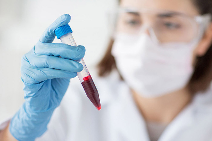 گروه خونی که بیشتر از همه سکته مغزی می‌کند!