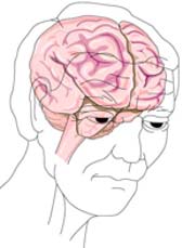 «آلزایمر» دزد حافظه 