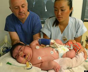  سنگین ترین نوزاد به دنیا آمد (+عکس)  